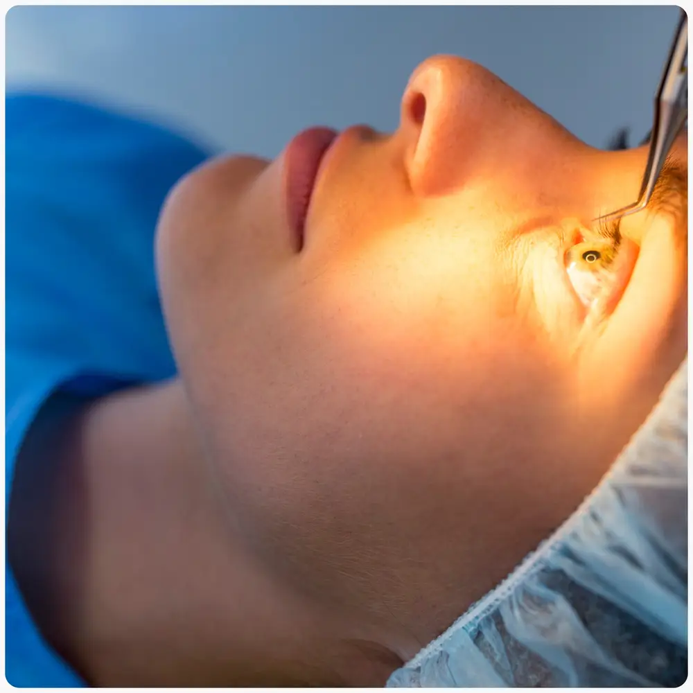 طب وجراحة العيون